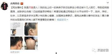 小美弟弟爆料视频全集免费观看,揭秘背后惊人真相 第2张 小美弟弟爆料视频全集免费观看,揭秘背后惊人真相 第2张